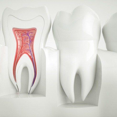 a graphic illustration depicting the inner chamber of a tooth