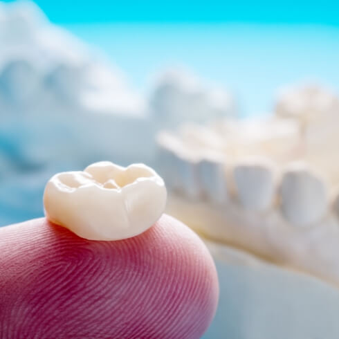 Dental crown restoration on fingertip