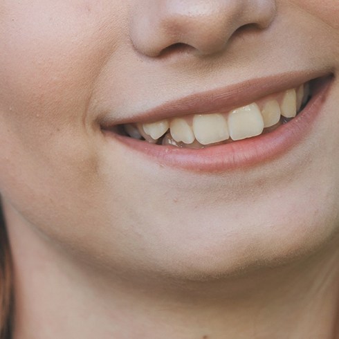 A close-up of a young girl’s crooked smile 