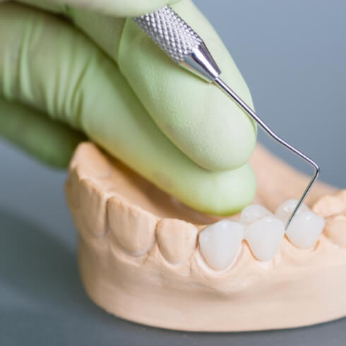 Dental lab technician crafting a fixed bridge dental restoration