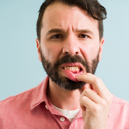 Man in pink shirt pulling down lip to show gums