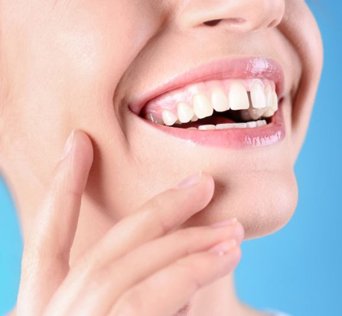 Woman’s smile with a gap between the front teeth