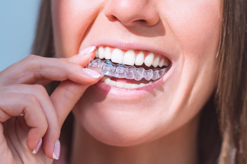 A woman removing her clear aligner trays from her smile