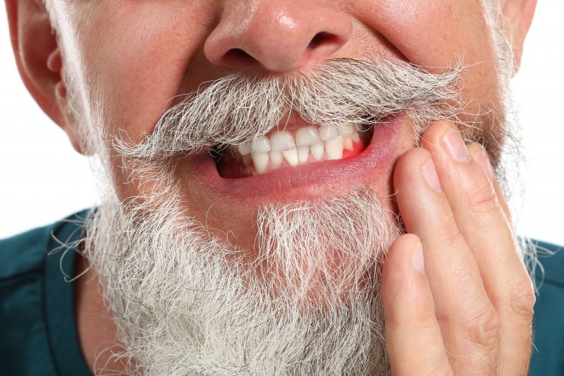 A closeup of an older, bearded man with inflamed gums