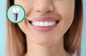 Woman with dental implants smiling